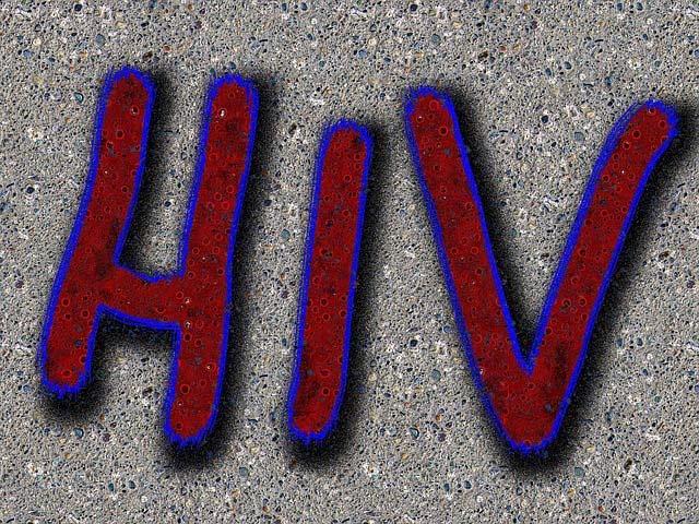 hiv-m